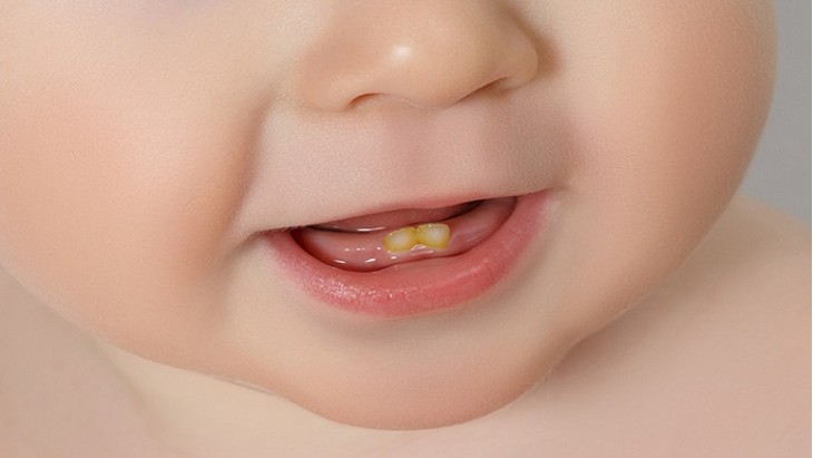  Редоследот на никнење запчиња е различен кај секое бебе